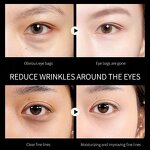 Caffeine Under Eye Patches Factory - OEM Private Label Lighten Dark