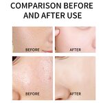 Golden Peeling Off Mask Factory - OEM OEM Natural Skin Care Wrinkle