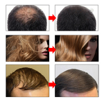 Ginger Hair Growth Oil Supplier - OEM Private Label Natural Organic