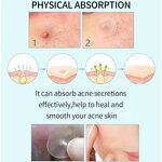 Waterproof Acne Patch Manufacturer - OEM Private Label Custom Spot