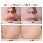 Turmeric Skin Care Set Manufacturer - OEM Private Label OEM Natural Organic