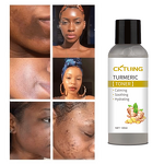 Turmeric Skin Toner Manufacturer - OEM Private Label OEM Natural Organic