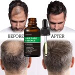 Hair Care Essence Manufacturer - OEM Private Label Hair Growth Oil