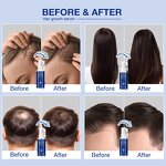 Hair Treatment Oil Supplier - Wholesale Private Label Anti-Hair Loss Ampoule Solution