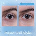 Eye Cream Supplier - Private Label for Dark Circles Bags Removal Collagen Rapid