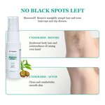 Hair Remover Spray Manufacturer - Herbal Natural Painless for Face Body