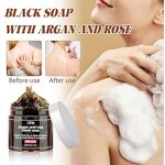 Acne Body Spray Supplier - CLEAR Salicylic Acid Barberry Extract Back Body Breakouts