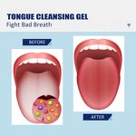 Tongue Cleaning Gel Manufacturer - Effective Silicone Removing Coating Improving Oral Hygiene