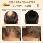 Hair Growth Serum Spray Manufacturer - OEM Wholesale Private Label Moisturizing Encourages