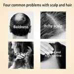 Hair Oil Supplier - Wholesale Private Label Organic Natural Indian Gooseberry Strong