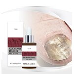 Nail Repair Essence Factory - Wholesale Nail Care Product Effective Regeneration Strengthening