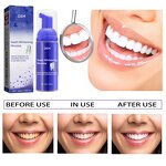 Teeth Whitening Mousse Supplier - OEM Private Label Multi-Purpose Brightening Mousse