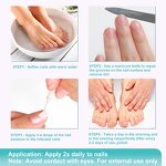 Nail Repair Pen Manufacturer - OEM Damaged Nail Onychomycosis Fungus Pen