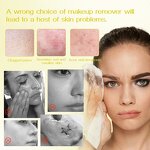 Micellar Water Manufacturer - OEM Gentle Cleansing All Skin Types Makeup Remover