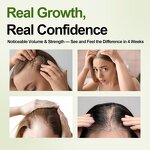 Hair Growth Foam Manufacturer - OEM Organic Plant Based Non Greasy