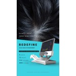 Hair Analyzer Manufacturer - HD Hair Follicles Scalp Scanner