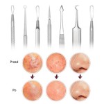 Blackhead Remover Set Factory - 8pcs Stainless Steel Pimple Removal