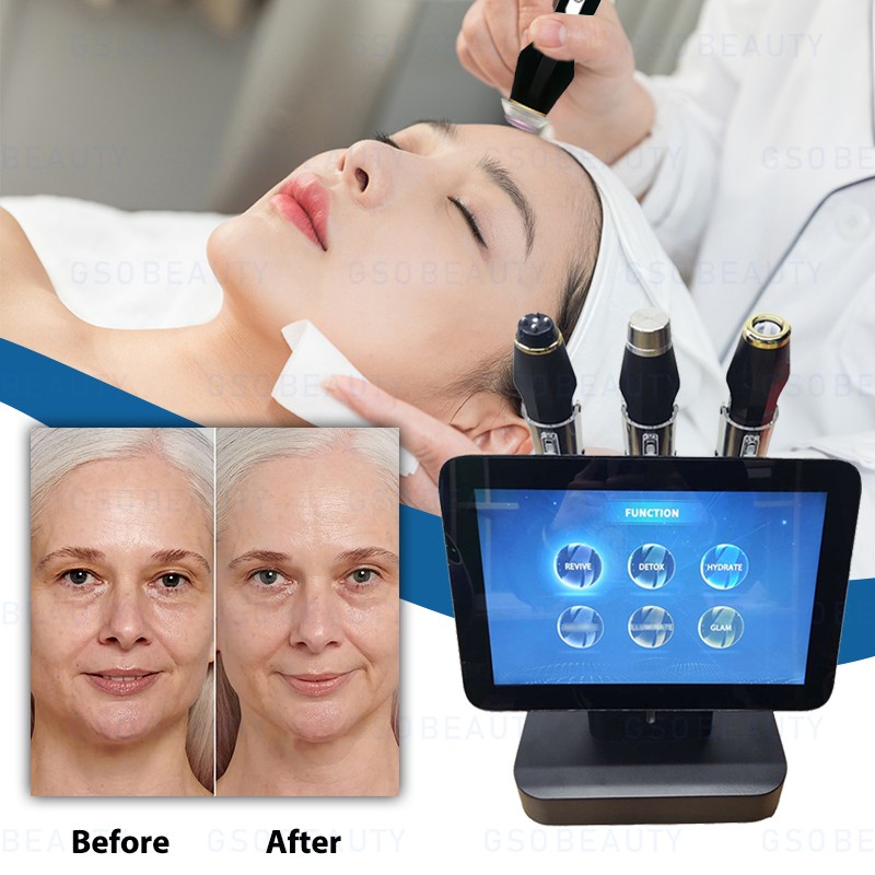 RF Microneedle Machine Supplier - 2025 Advanced Portable Fractional