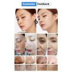 Hydrodermabrasion Machine Manufacturer - Korea Whitening Acne Facial