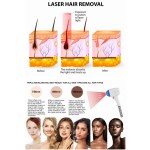 Laser Hair Removal Machine Supplier - High Power Triple Wavelength