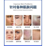 射频微针仪器生产厂家-微针面部提升
