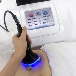 射频仪器供应商-专业私密紧致再生