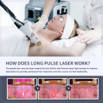 Laser Hair Removal Manufacturer - 1200W 3 Wavelength Diode