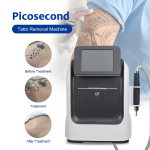 Laser Machine Manufacturer - Picosecond Q Switch Tattoo Removal