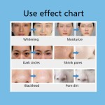 Hydrodermabrasion Machine Manufacturer - New Product Aqua Peel Up