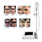准分子灯供应商- CE认证308nm UVB LED光疗