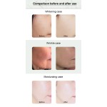 Hydro Dermabrasion Machine Supplier - 8 in 1 Aqua Peeling Ultrasonic