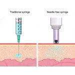 自动注射器源头工厂-面部唇部填充透明质酸笔