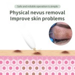 Plasma Pen Manufacturer - Dark Spot Wrinkle Removal 2 in 1