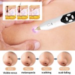 Medical Plasma Pen Factory - Hot Sale Eyelids Lifting Ozone