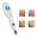 Plasma Device Manufacturer - Permeation Fractional Lifting Set