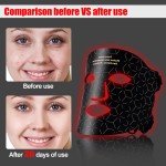 LED Facial Mask Factory - OEM/ODM 7 Color Wireless Eye Mask