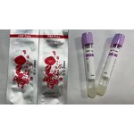 Blood Collection Tube Manufacturer - Vacuum PRF Tube ACD Gel Biotin