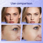 Micro Needling Pen Manufacturer - Hello Face H08 Liquid Bottle 12Pins