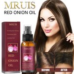 Red Onion Oil - MRUIS Natural Organic Scalp Nourishing Hair Growth