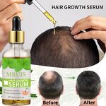 Whitening Cream - Best Golden Pearl Strong for Dark Black Skin Body Face