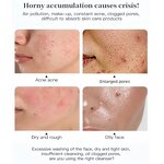 Anti Acne Cleanser - Salicylic Acid Foaming Face Wash Deep Cleansing Mousse