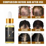 Hair Oil - Plant-based Anti-itching Repairing Precisely Moisturize