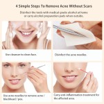 Pimple Popper Kit Supplier - Wholesale Stainless Steel Extractor