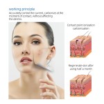 Fibroblast Plasma Pen Supplier - Professional Picosecond Eyelid