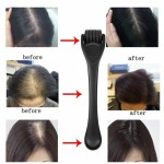 Derma Roller Manufacturer - 540 Titanium Matte Black