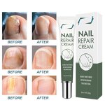 Nail Repair Cream Manufacturer - OEM/ODM Private Label Herbal Lightweight Skin-Friendly Best Fungal Treatment for Foot Care