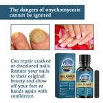 Nail Repair Serum Gel Manufacturer - Maximum Strength Anti-Infection for Onychomycosis Paronychia Fungal Treatment