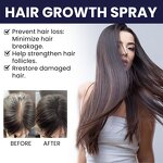 Hair Growth Spray Manufacturer - Private Label 100% Organic Herbal Treatment Repairing Regrowth Oil Serum
