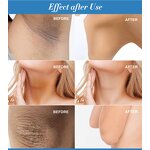 Whitening Cream Manufacturer - Dark Spot & Fine Pores Lightening for Knees Hands Armpits