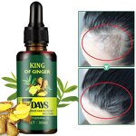 Ginger Essential Oil Manufacturer - 7 Days Pure Improving Hair Growth Anti Hair Loss Treatment for Men
